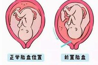 济源试管男孩医院排名？附试管费用详情？