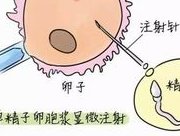 贵阳比较好的第二代试管婴儿医院是哪家医院？成功率如何？