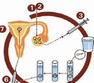 哪些医院可以进行少精症试管婴儿治疗？